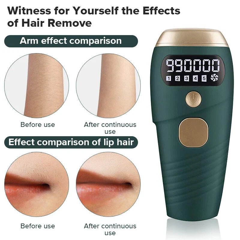 TAVICE IPL Hair Removal Device for Women and Men, 990,000 Flashes, At-Home Intense Pulsed Light Hair Remover for Face, Arms, Legs, Underarms, Bikini Line and Body - Office Catch